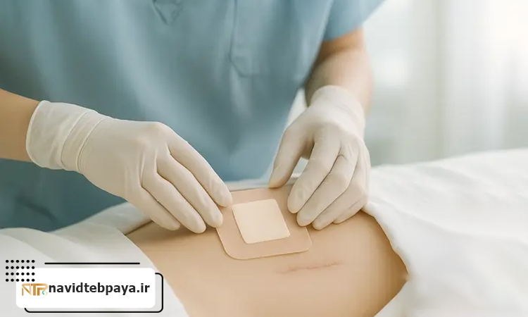 اهمیت محصولات درمان زخم تخصصی؛ کلید بهبود سریع تر و بدون عارضه